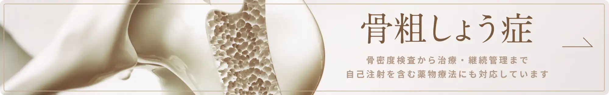 骨粗しょう症 骨密度検査から治療・継続管理まで自己注射を含む薬物療法にも対応しています
